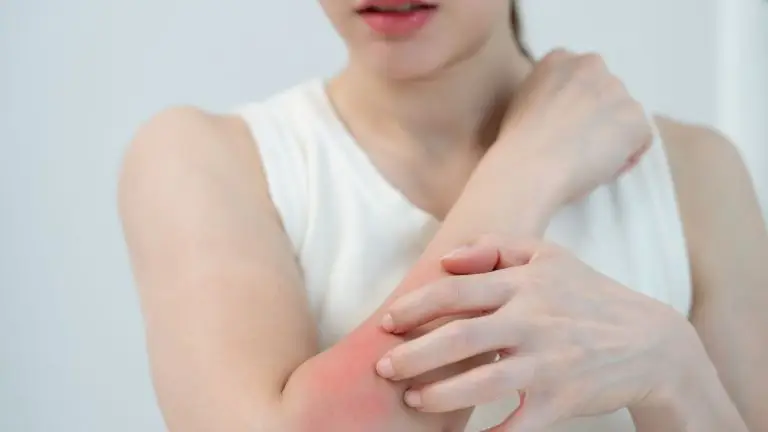 does oxycodone make you itch